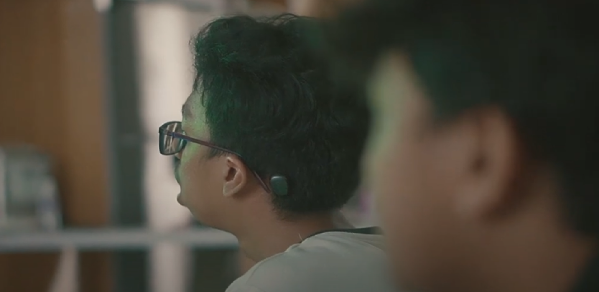 Ini yang Perlu Dipahami Tentang Bone-Anchored Hearing Aid