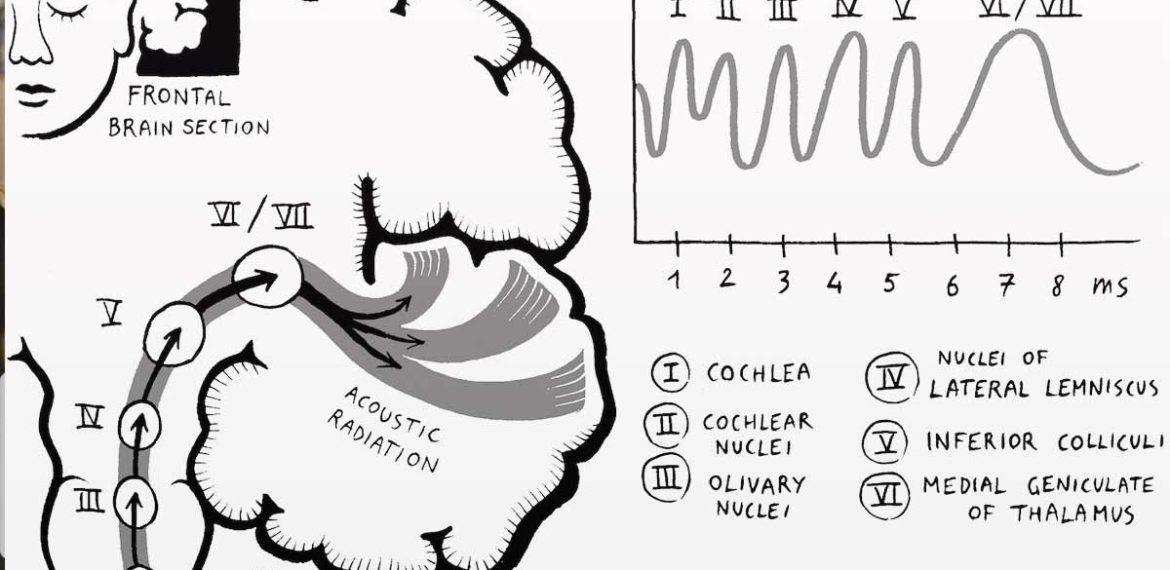 Auditory Brainstem Response (ABR)