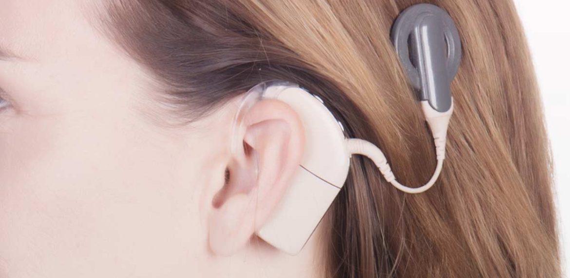 Manfaat Cochlear Implant
