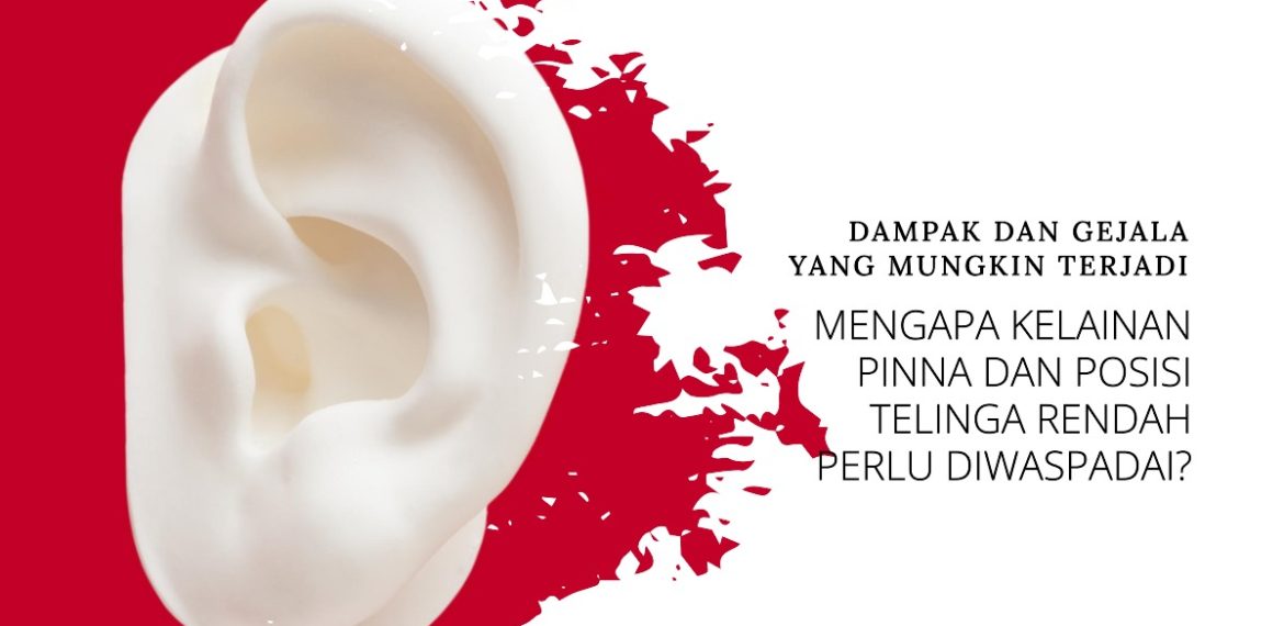 Kelainan Pinna dan Posisi Telinga Rendah