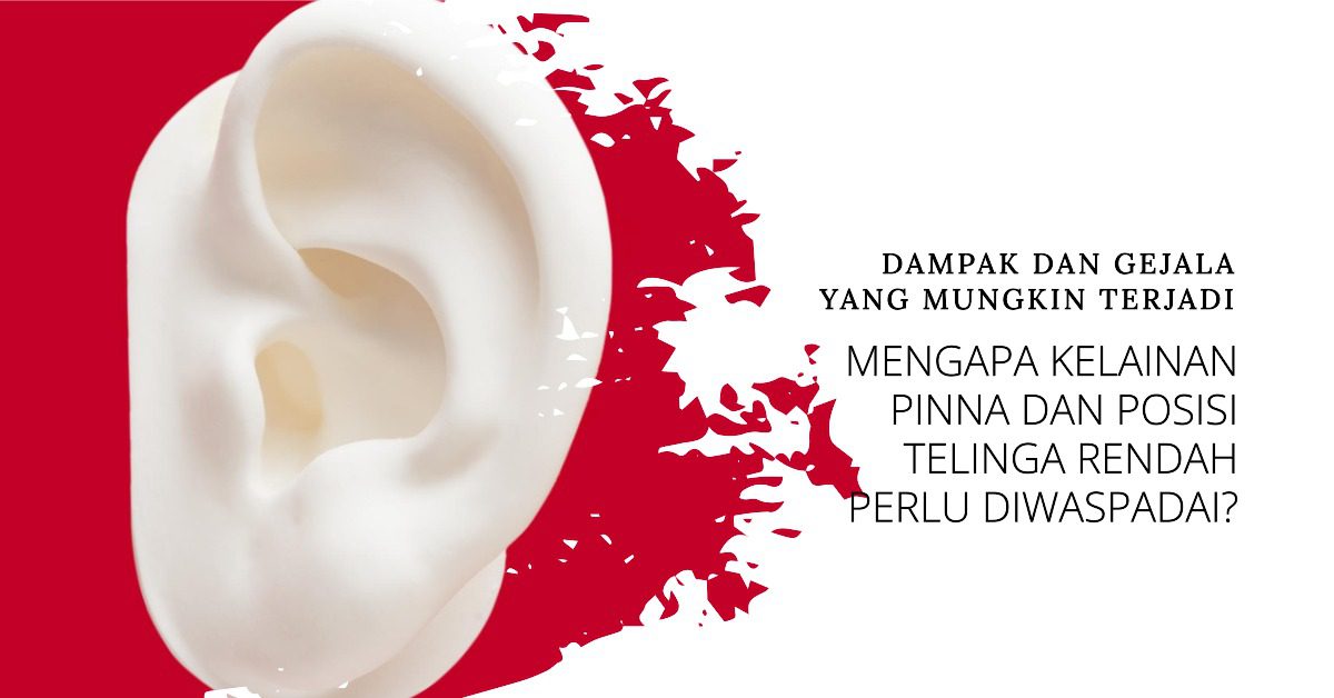 Kelainan Pinna dan Posisi Telinga Rendah