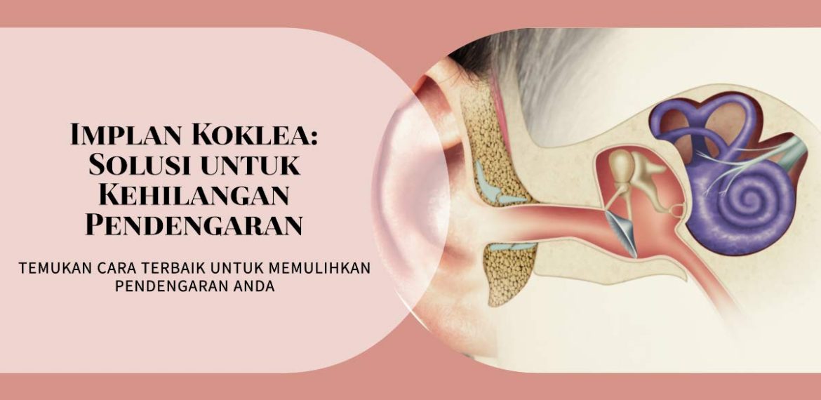 Siapa Saja yang Dapat Menggunakan Implan Koklea?