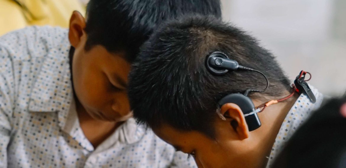 Meet and Greet Cochlear Implant by Kasoem