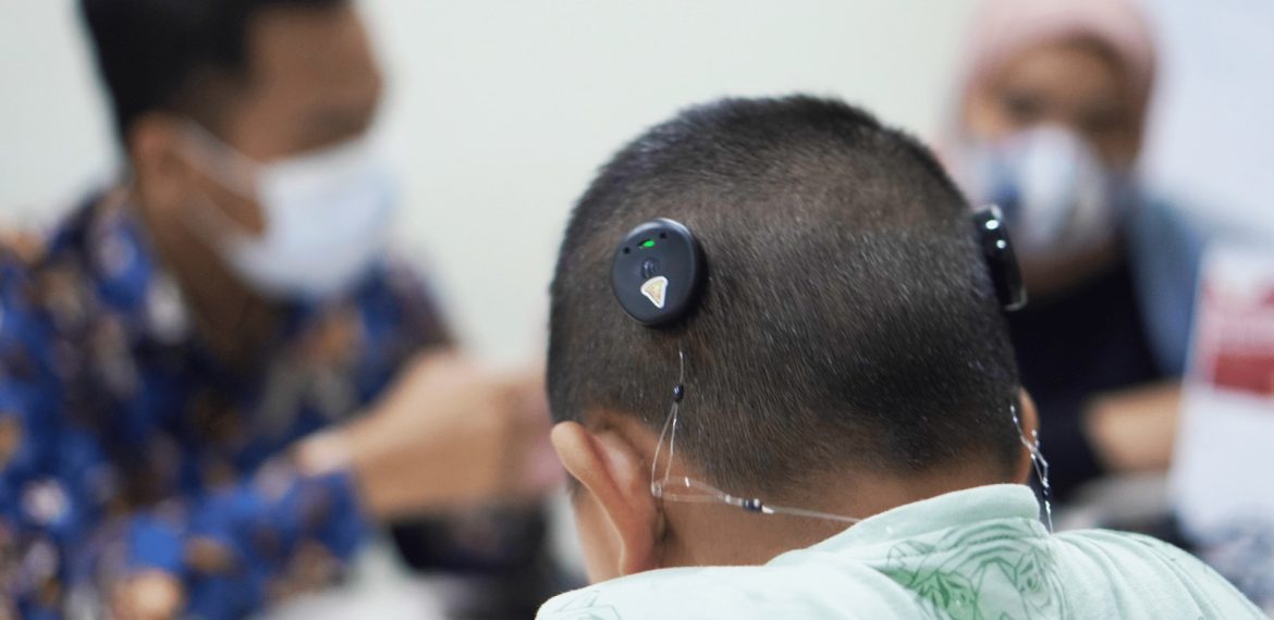 Pentingnya Mapping Rutin untuk Pengguna Cochlear Implant
