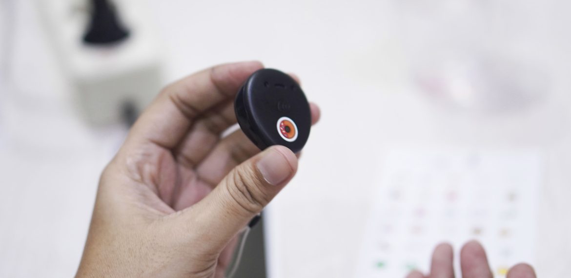 Cochlear Implant Adalah Apa