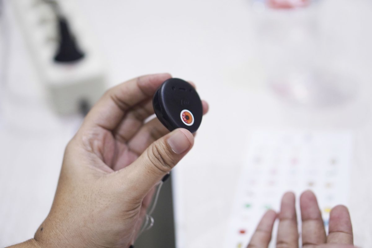 Cochlear Implant Adalah Apa