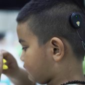 Hearing Aid Terbaik