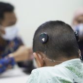 Ketahui apa itu implan koklea anak, biaya operasi, harga alat bantu dengar, hingga pusat alat bantu dengar terbaik di Indonesia. Solusi pendengaran terpercaya.