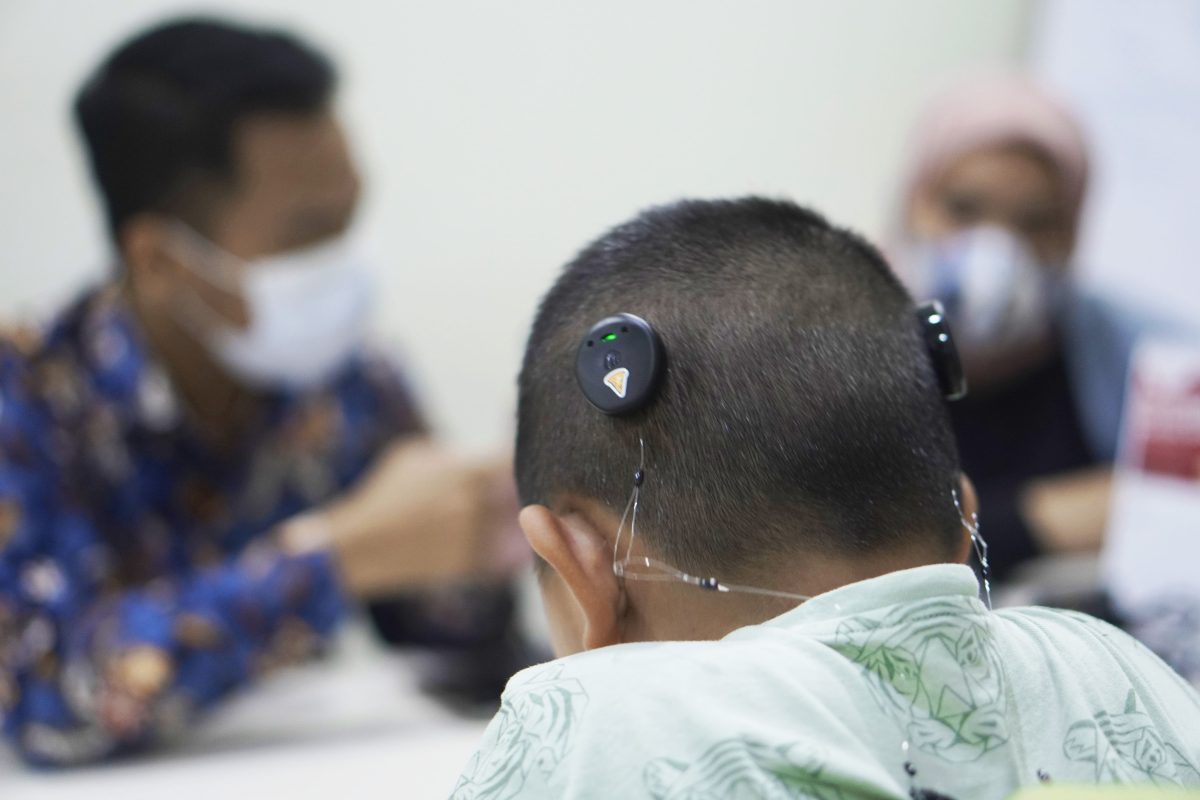 Manfaat Implan Koklea Anak