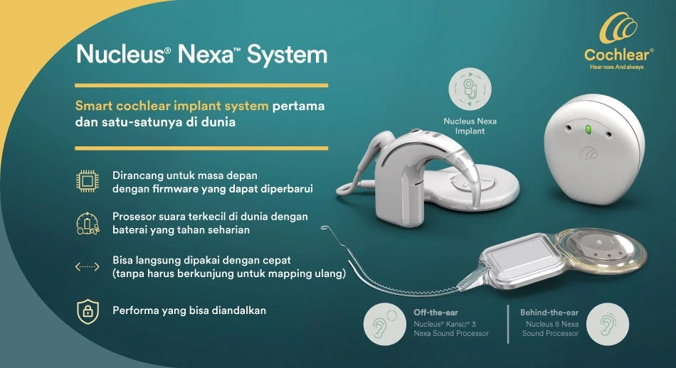 Cochlear Nucleus Nexa System